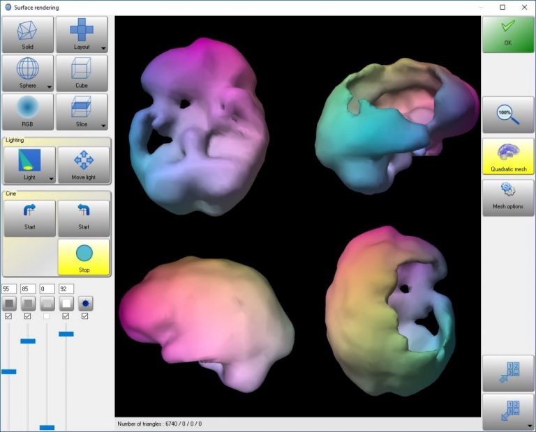 Dieses Bild zeigt eine nuklearmedizinische 3D-Darstellung eines Hirns in der Auswertung mit der Auswertesoftware aus dem Paket Evo-Software für UniCam einer Gammakamera von Inter Medical Medizintechnik.