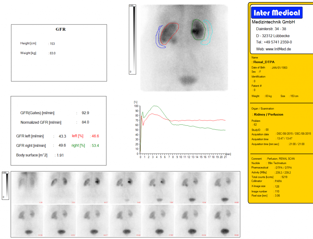 Dieses Bild zeigt eine nuklearmedizinische Nierenauswertung RENAL DPTA mit der Auswertesoftware aus dem Paket Evo-Software für UniCam einer Gammakamera von Inter Medical Medizintechnik.